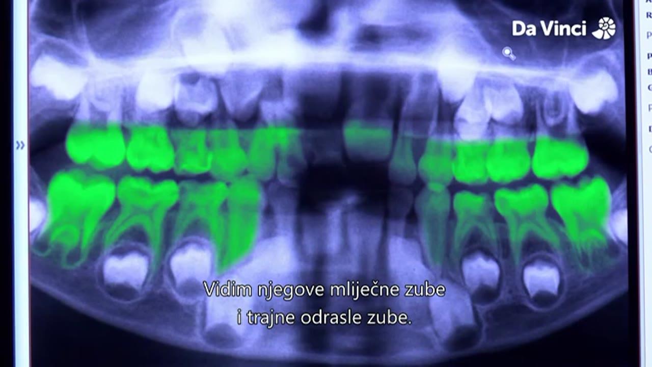 Operacija Boli! (Zašto kosti pucaju?) / 0